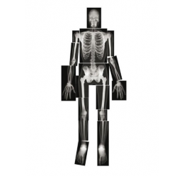 Kūno rinkinys-skeletas