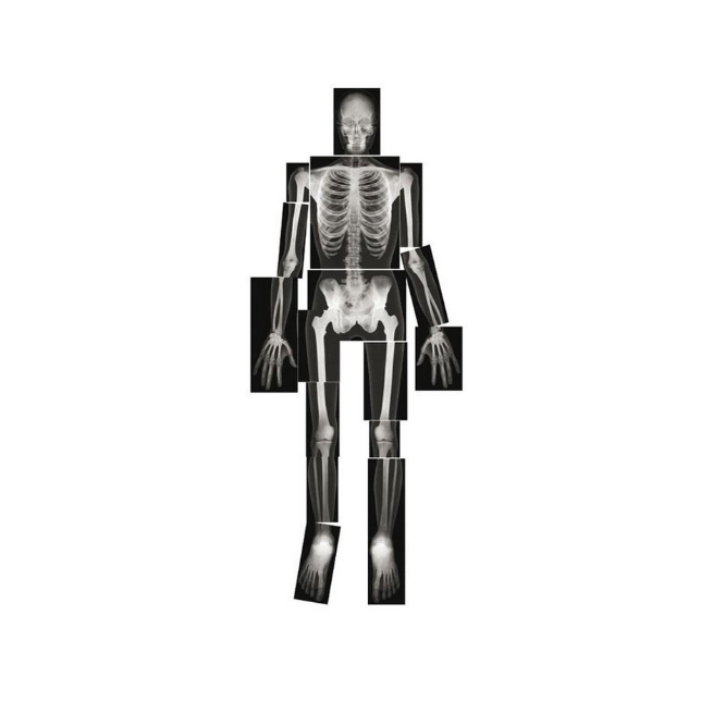 Kūno rinkinys-skeletas